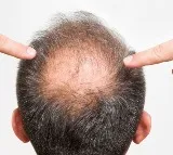 Salman Delhiwala Hair Growth Scam Busted in Hyderabad Old City