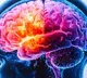 Study finds genetic link for rare childhood brain developmental disorder