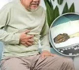 Yang 64 year old man tooth brush removed after 52 years
