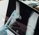 Indian researchers develop diagnostic device to detect early-stage bone cancer