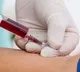Leukemia Early Detection Painless Blood Test Discovered