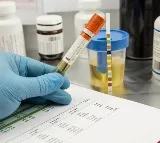 Uric Acid Linked to Heart Attack Risk