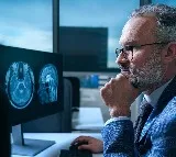 Stateviewer AI Tool Detects 9 Types of Dementia with Single Scan