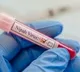 425 under surveillance as Kerala battles fresh Nipah virus outbreak