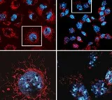 Study decodes why promising cancer treatments trigger serious side effects