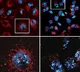 Study decodes why promising cancer treatments trigger serious side effects