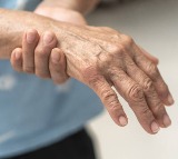 Nerve Weakness 5 Signs You Should Know