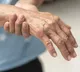 Nerve Weakness 5 Signs You Should Know
