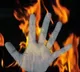 Odisha self-immolation case: Student succumbs to injuries
