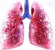 Lung TB: Higher dose of rifampicin safe, can boost recurrence-free survival, says ICMR study