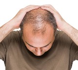 Hair Loss Home Remedies Tips