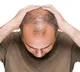 Hair Loss Home Remedies Tips