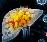 Jaundice Causes Symptoms and Prevention Tips