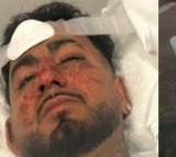 Indian Student Hospitalised After Alleged Racist Attack In Adelaide