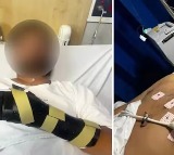 Saurabh Anand Attacked in Australia Left Hand Severely Injured