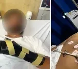 Saurabh Anand Attacked in Australia Left Hand Severely Injured