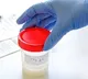 Hyderabad Sperm Clinic Racket Exposed Police Raid