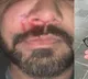 Indian Origin Mans Face Fractured In Unprovoked Racist Attack In Ireland