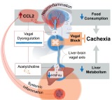 Study identifies reasons behind deadly weight loss in cancer patients