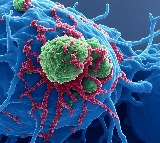 Study finds new genomic risk factors for uterine cancer