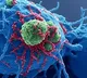 Study finds new genomic risk factors for uterine cancer