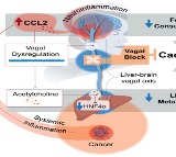 Study identifies reasons behind deadly weight loss in cancer patients