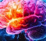Women with Down syndrome at high risk of Alzheimer's disease: Study