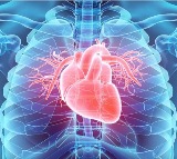 COVID19 Premature Aging of Blood Vessels Increases Heart Attack Risk