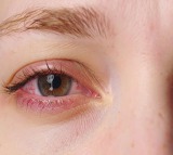 Just 1 hour of social media reels on smartphones can cause eye fatigue says Study