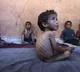 Gaza Officially Declared as Famine Zone by United Nations