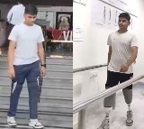  Warangal IIT Aspirant Walks Again with Revanth Reddys Help