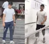 Warangal IIT Aspirant Walks Again with Revanth Reddys Help