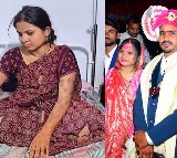 Madhya Pradesh Man Tortures Wife Khushboo Pipliya with Heated Knife