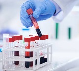 Understanding Your Complete Blood Count CBC Test Report