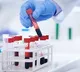 Understanding Your Complete Blood Count CBC Test Report