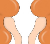 Madras HC quashes denial of kidney transplant over 'proof of friendship'