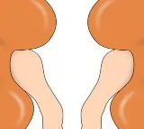 Madras HC quashes denial of kidney transplant over 'proof of friendship'