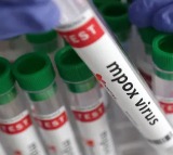 WHO says mpox no longer a global public health emergency