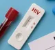 Patient Contracts HIV During Kidney Treatment Dialysis Center Protest