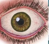 Heart Attack Symptoms Can Be Detected Early with Eye Exam