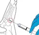 Lin Shanfeng Chinese Researchers Invent Bone Mending Glue