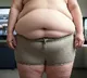Here's why obesity affects people differently
