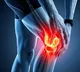 Study shows rheumatoid arthritis begins years before symptoms appear