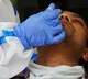Loss of smell may linger for years after Covid19 Says Study