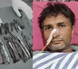 Doctors Shocked to Find 29 Spoons 19 Toothbrushes in Mans Stomach in Ghaziabad