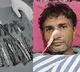 Doctors Shocked to Find 29 Spoons 19 Toothbrushes in Mans Stomach in Ghaziabad