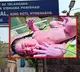 King Koti Hospital Hyderabad witnesses rare delivery of 5 kg baby