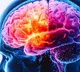 Deadly brain cancer can alter skull, immune response: Study