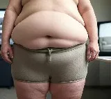 Severe obesity causes lungs to age prematurely: Study