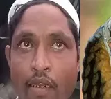 UP Man Claims Wife Turns Into A Snake At Night And Bites Him